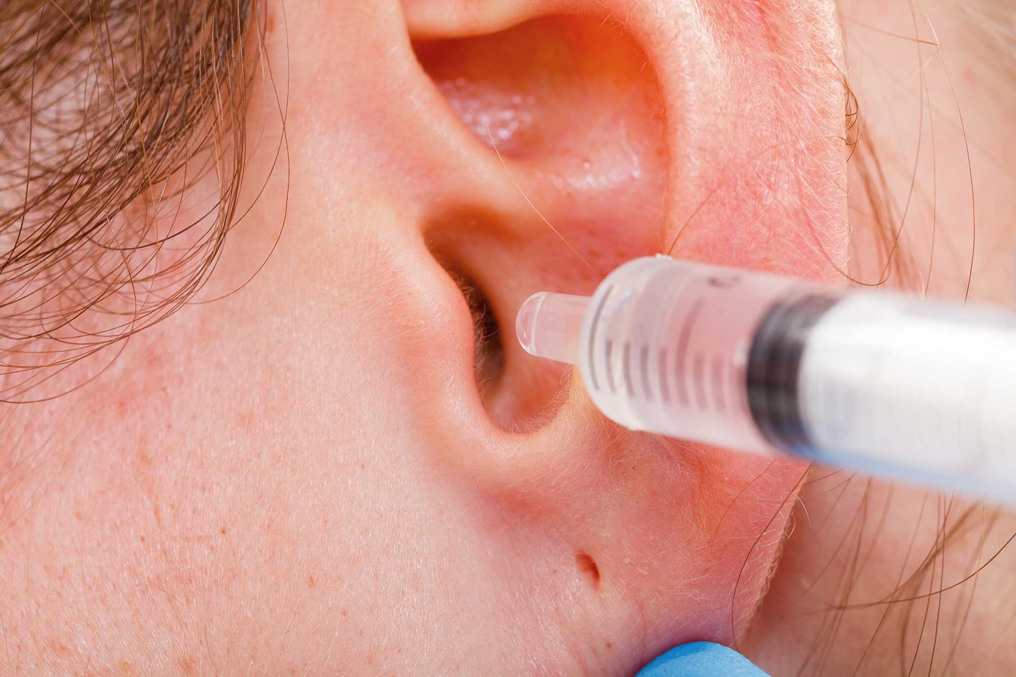 What is the Best Way to Clean My Ears? U.S. Hearing Solutions